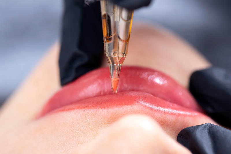 BB_LipPigmentation_Img_1